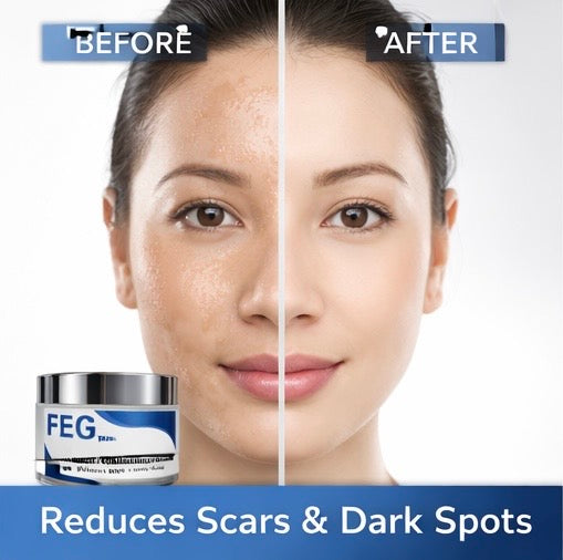 FEG PLUS Medicated Whitening Cream
